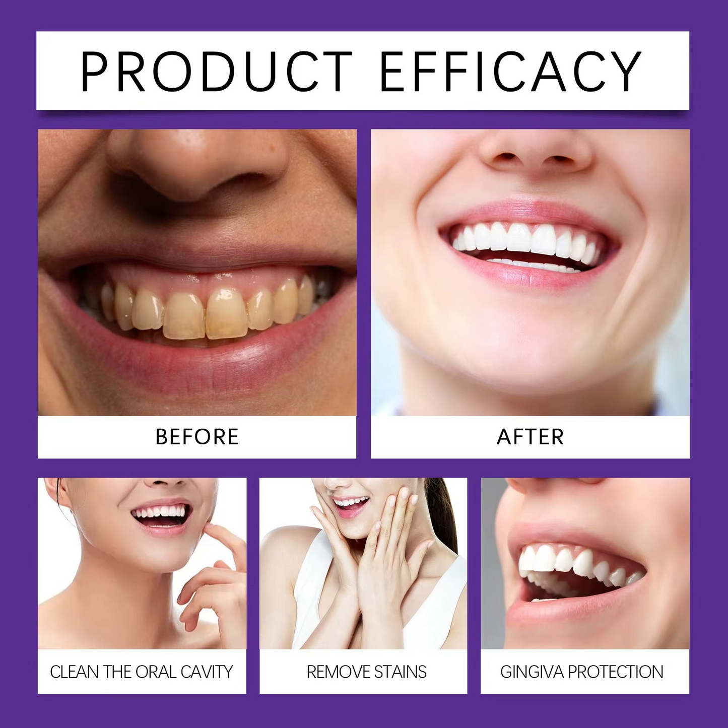 💜 Poudre de blanchiment des dents violette – Le secret de votre sourire blanc éclatant !
